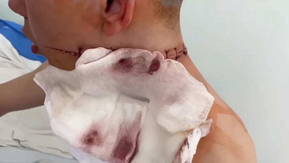 В Новокузнецке парень пытался отрубить своему знакомому голову мачете